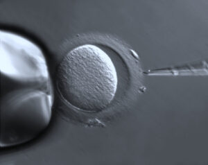 Read more about the article Infertility and IVF